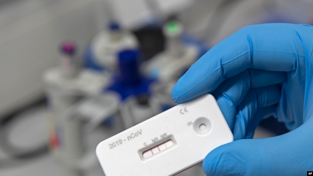 A scientist presents an antibody test for coronavirus in a laboratory of the Leibniz Institute of Photonic Technology (Leibniz IPHT) at the InfectoGnostics research campus in Jena, Germany, Friday, April 3, 2020. 