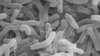 Cholera bacteria