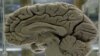Belief About Source of Intelligence Affects Effort